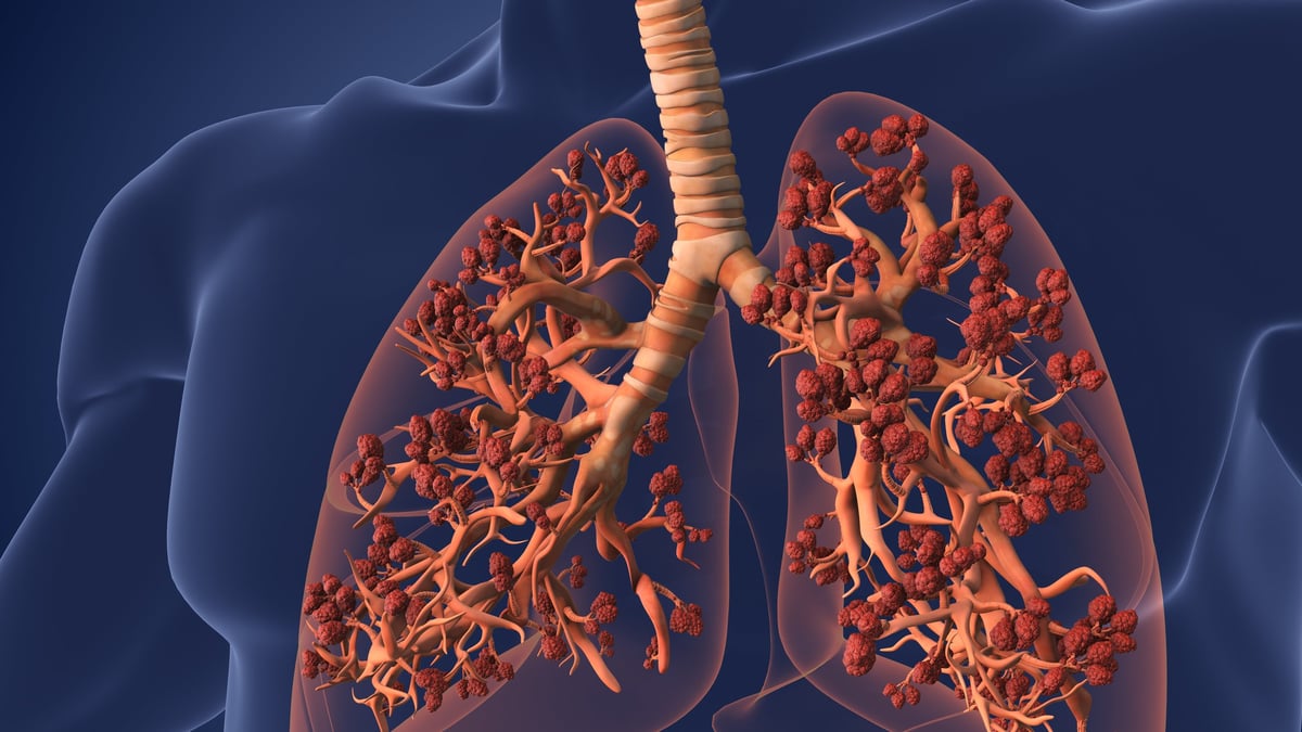 Vista microscópica de los alvéolos pulmonares y los capilares donde el oxígeno pasa a la sangre y el dióxido de carbono se libera