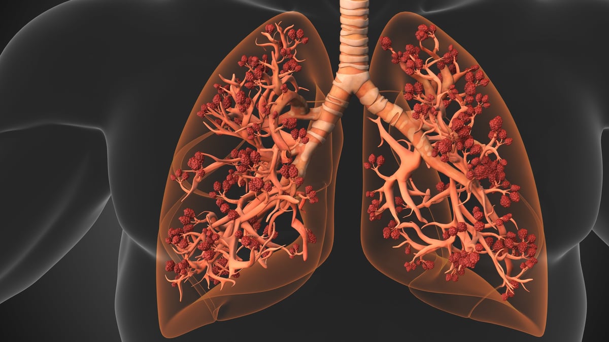 Alveolos donde los pulmones y la sangre intercambian oxígeno.