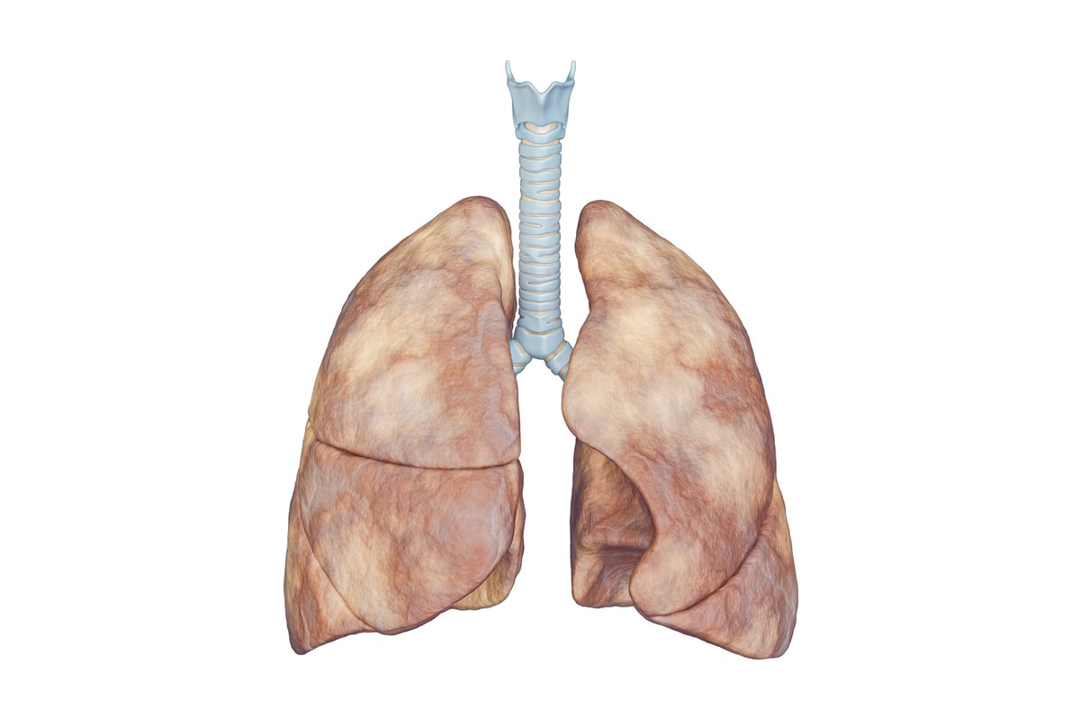 Ilustración anatómica de los pulmones con la tráquea y los bronquios, para explicar el asma y la inflamación de las vías respiratorias